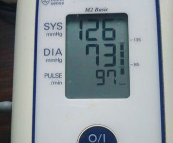 misurazione dopo la ricezione MiCardium